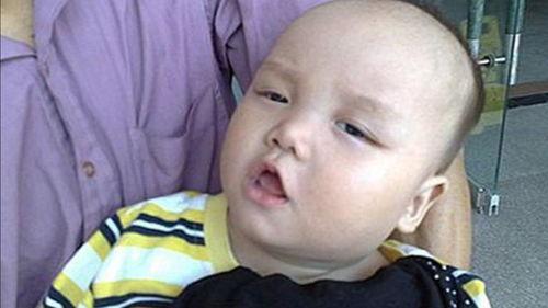 为啥吃瓜舌头疼